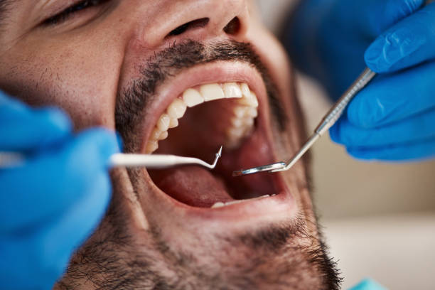 Best Emergency Broken Tooth Repair in Troy, IL